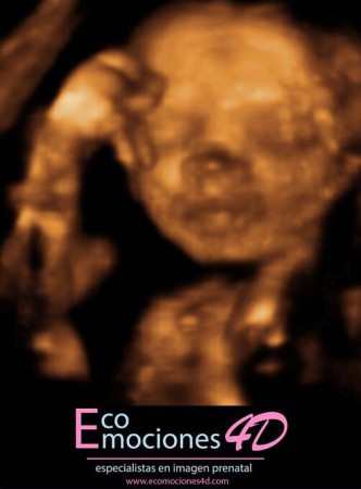 Ecografia 4D